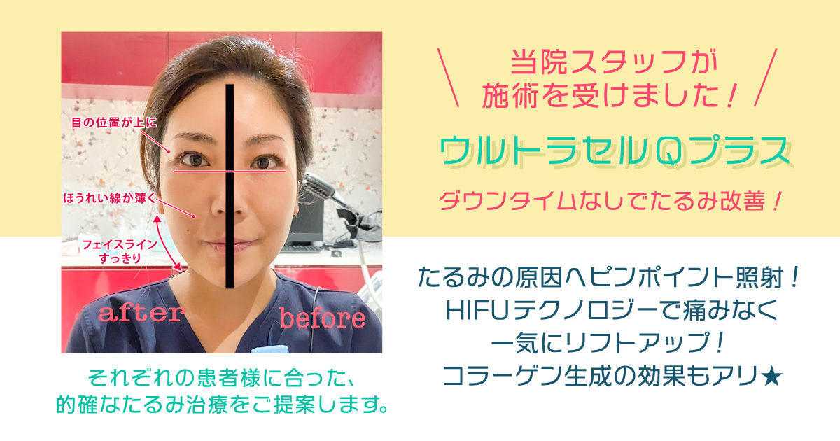 自分に合ったたるみ治療を 恵聖会クリニック 大阪の美容外科 美容皮膚科