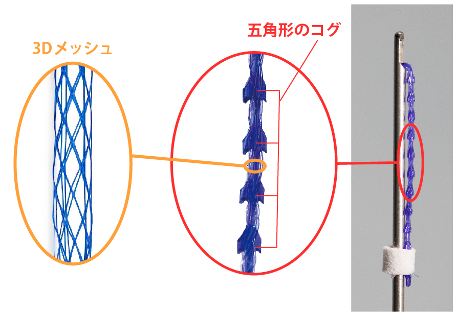 糸の構造