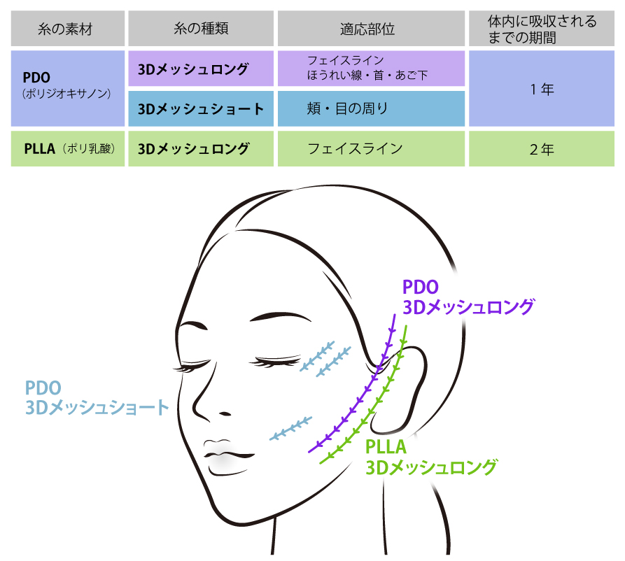 糸の種類と使用