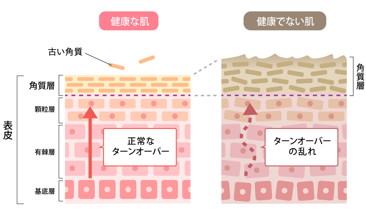 健康な肌と健康でない肌の図