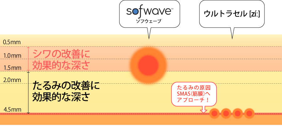 ウルトラウェーブの作用イメージ